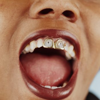 wil-je-een-tooth-gem-of-grill-deze-experts-vertellen-alles-wat-je-moet-weten-over-tandjuwelen-243417