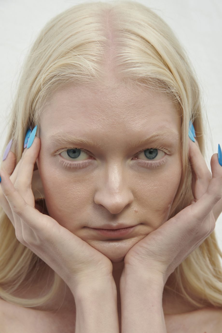 ik-probeerde-botox-twee-keer-en-haatte-het-dit-is-waarom-251362