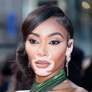 winnie-harlow-deelt-de-krachtige-boodschap-achter-haar-halloweenkostuum-273586