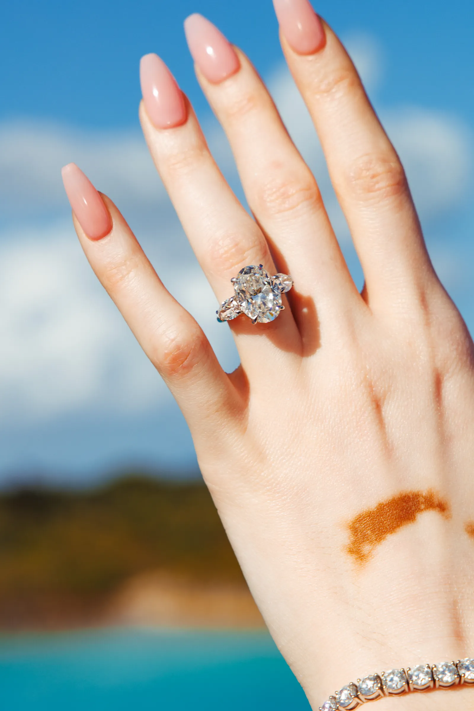 De verlovingsring van Winnie Harlow