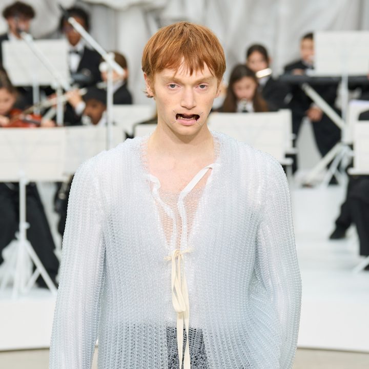 ik-heb-een-halfjaar-een-onzichtbare-beugel-en-dit-is-het-resultaat-376702