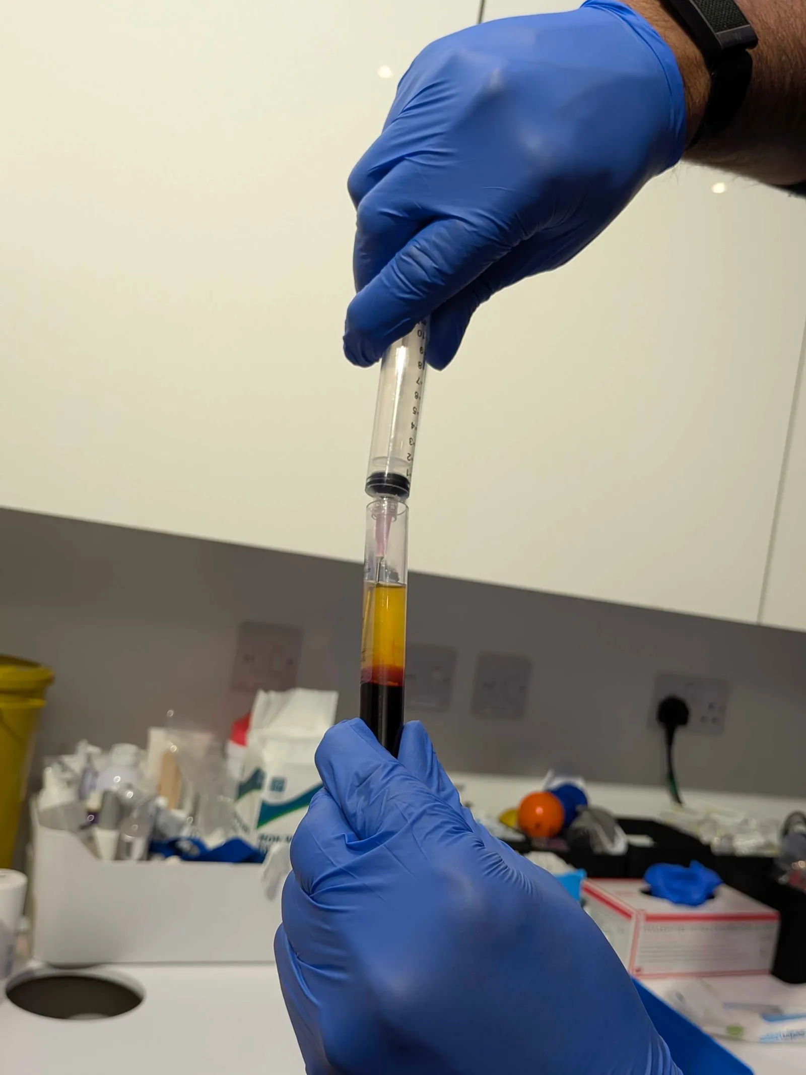 Beelden van het centrifugeren van het bloed